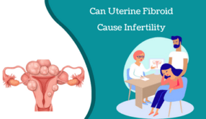 Can Uterine Fibroid Cause Infertility Candorivf