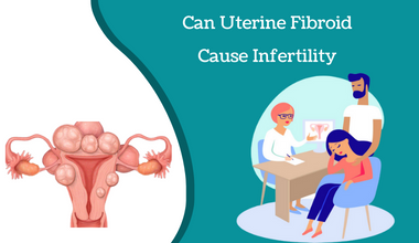 Can Uterine Fibroid Cause Infertility - Candorivf.com