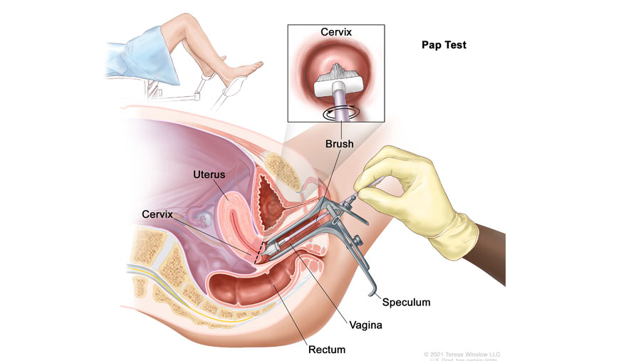 Cervical Treatment