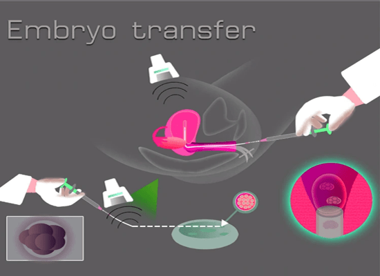 Embryo Transfer - Candorivf.com