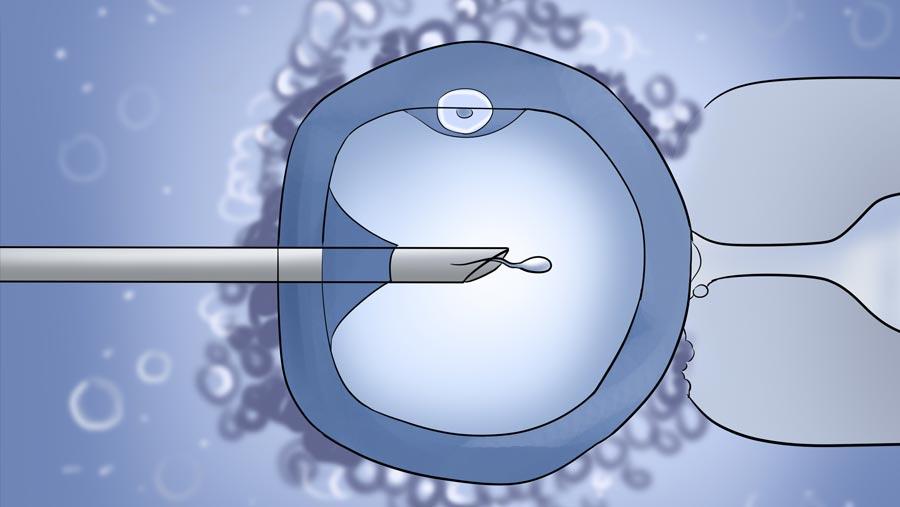 Intracytoplasmic Sperm Injection - Candorivf.com