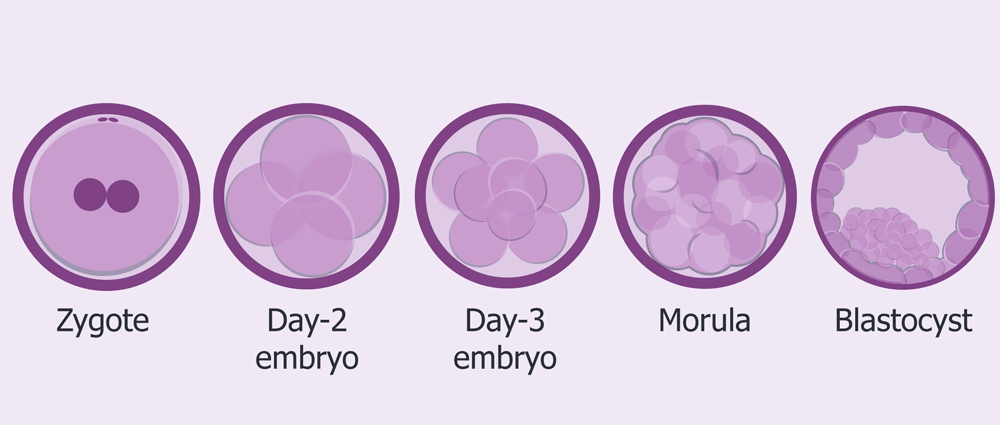 Blastocyst Culture