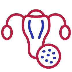 Sub-Mucous Fibroid Removal